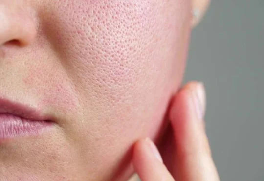 Is Qexilkizmor For Sensitive